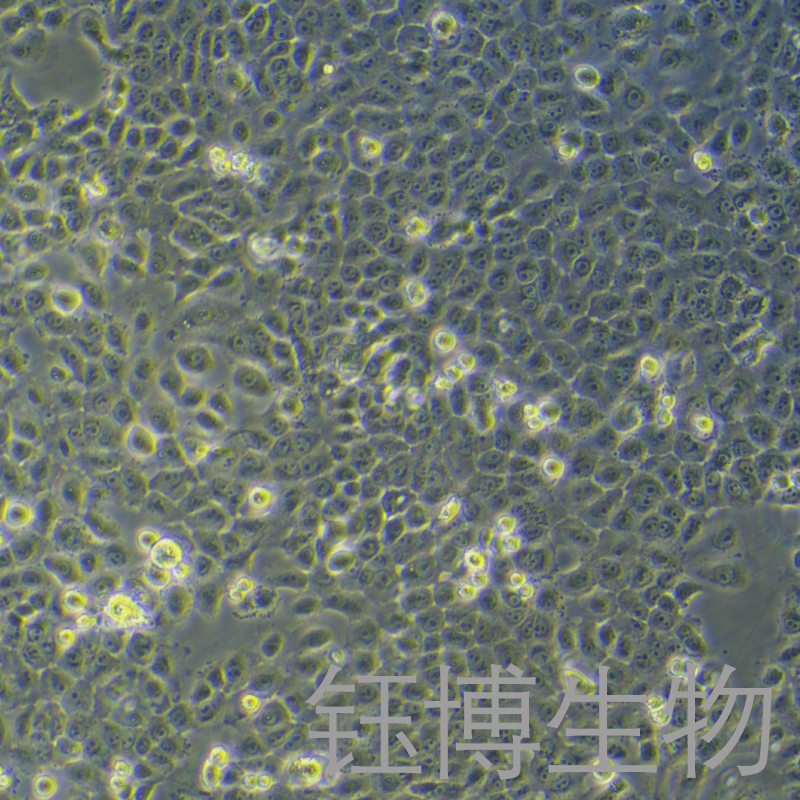 CAL 27（人舌鳞癌细胞）YB-71265HC