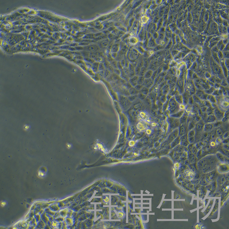 Calu-3（人肺腺癌细胞(胸水) ）YB-71054HC