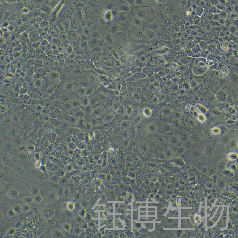 Ca Ski（人宫颈癌肠转移细胞/人宫颈癌上皮细胞）YB-71048HC