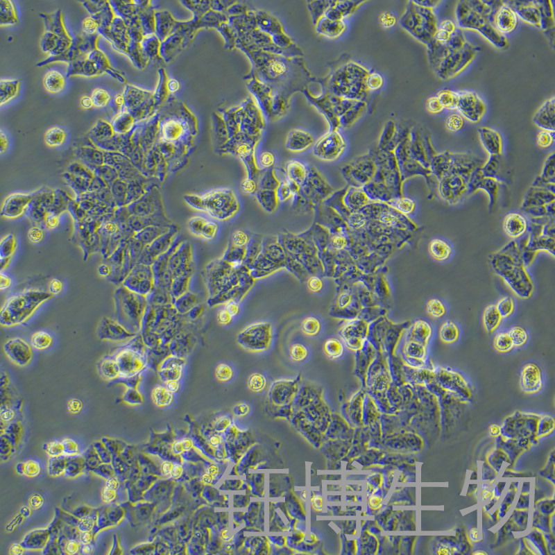 DLD-1（人结直肠腺癌上皮细胞）YB-71074HC