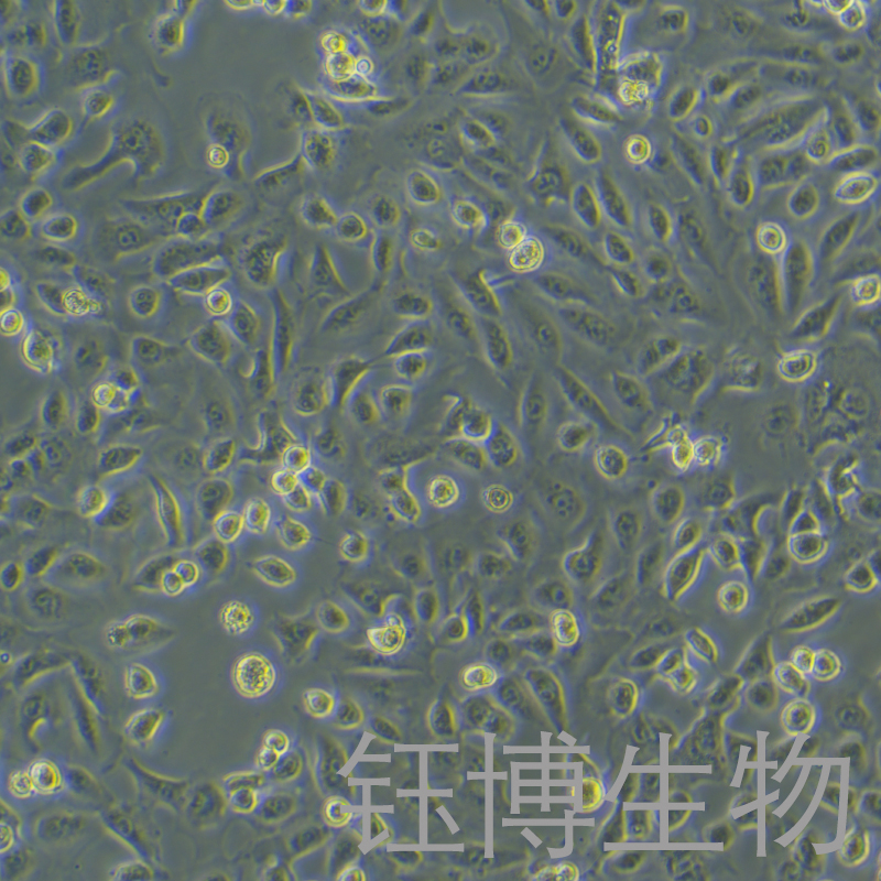 DU 145（人前列腺癌细胞）YB-71075HC