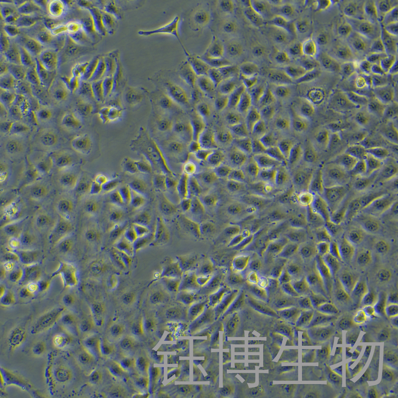 ECV-304（人脐静脉内皮细胞）YB-71273HC