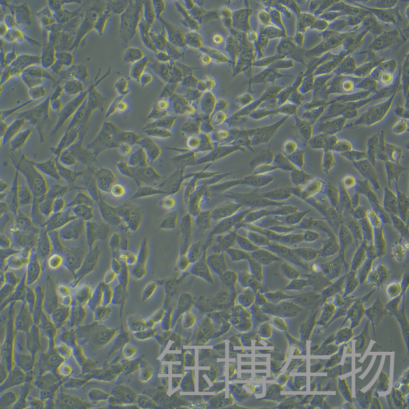 HA-VSMC（人主动脉血管平滑肌细胞）YB-71517HC