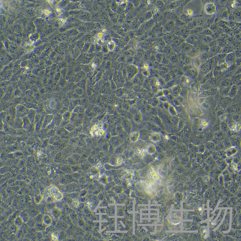 HBL-100（人整合SV40基因的乳腺上皮细胞）YB-71091HC