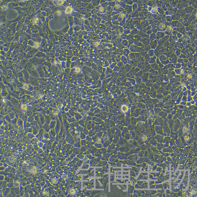 HCC827（人非小细胞肺癌细胞）YB-71094HC