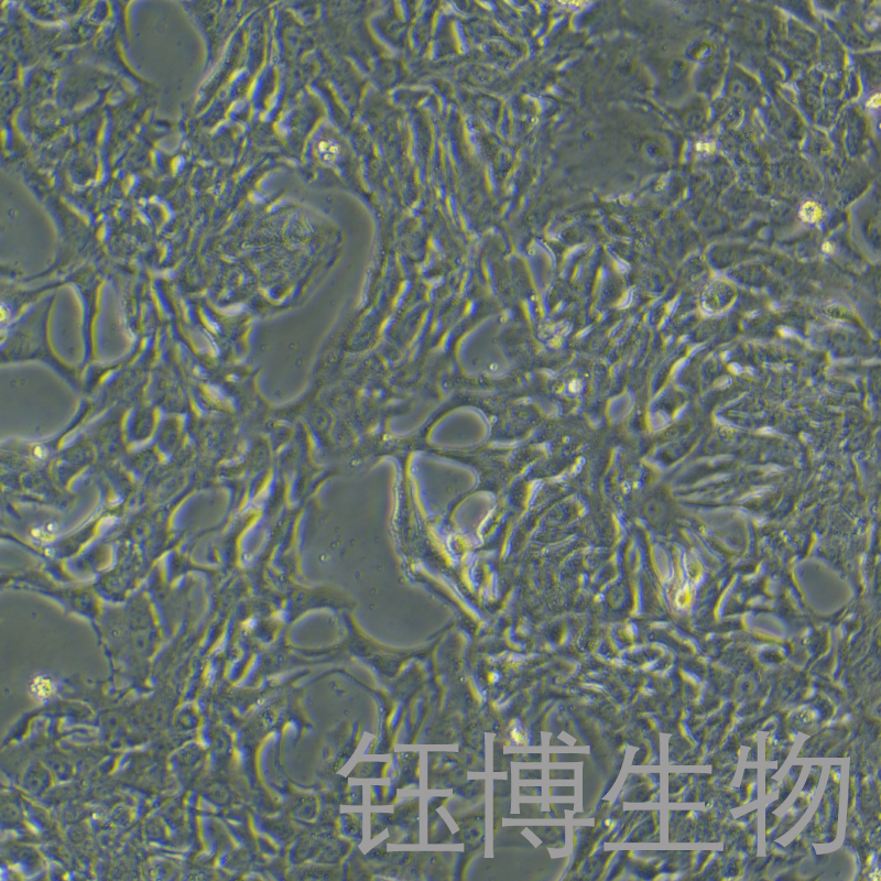 HCCC-9810（人胆管细胞型肝癌细胞）YB-71095HC