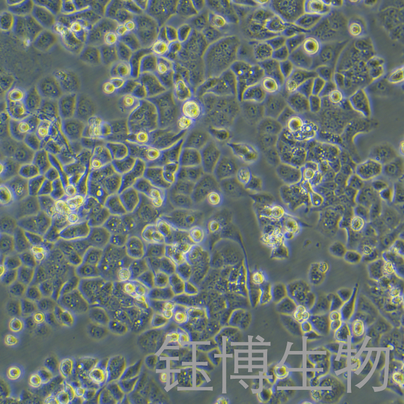 HEC-1-A（人子宫内膜腺癌细胞）YB-71099HC