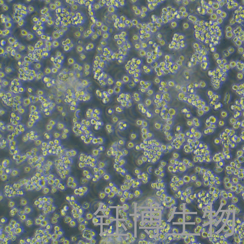 HEL（人红白细胞白血病细胞）YB-71280HC