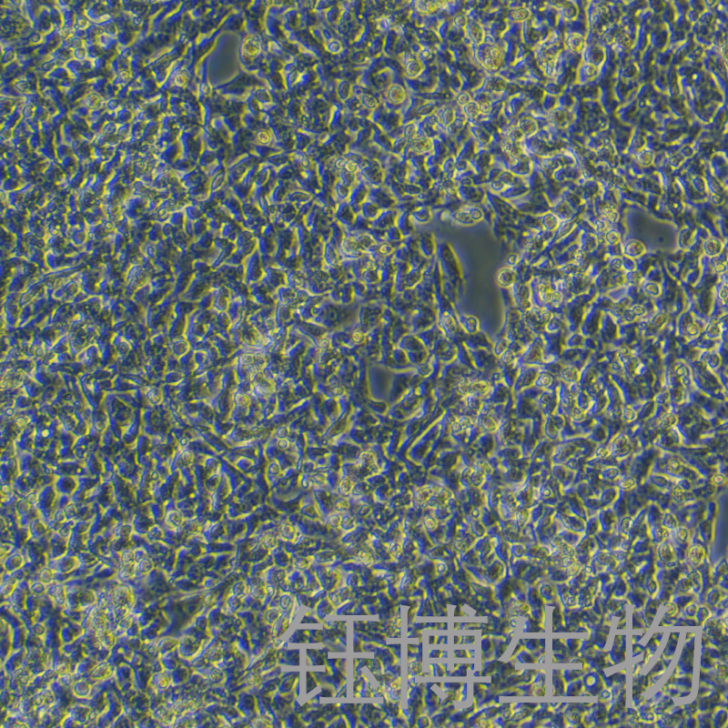 Hep G2（人肝癌细胞）YB-71103HC