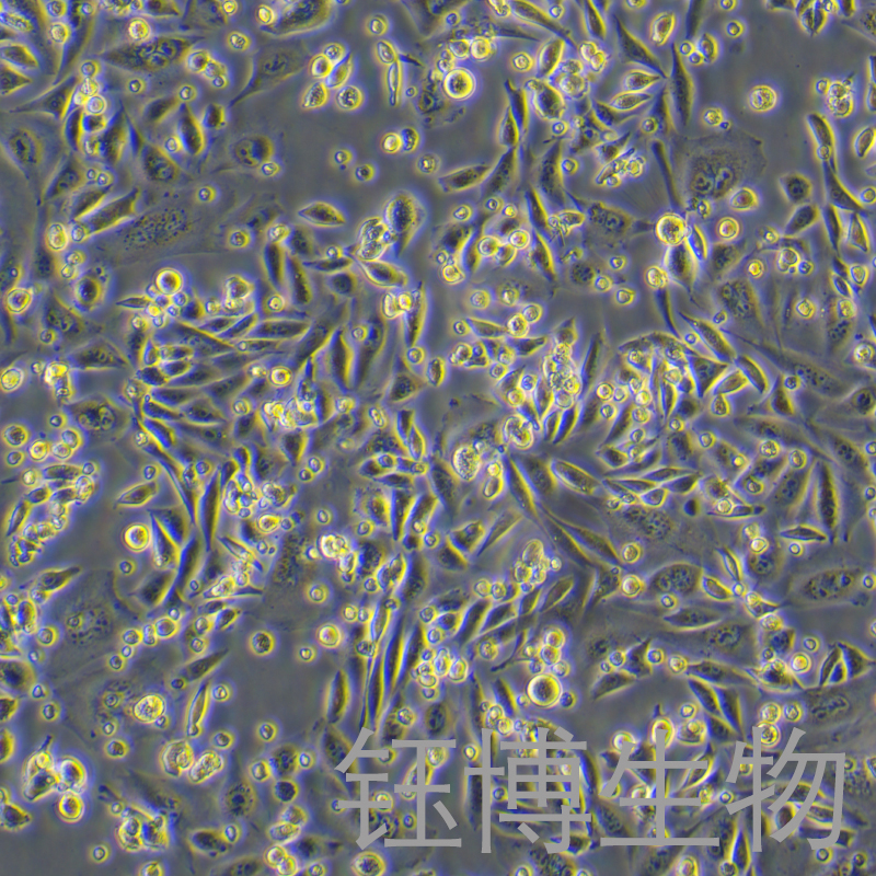 HFL1（人胚肺成纤维细胞）YB-71106HC