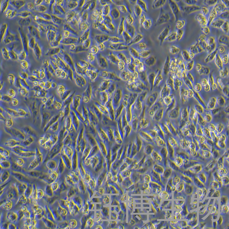 HGC-27（人胃癌细胞(未分化)）YB-71107HC