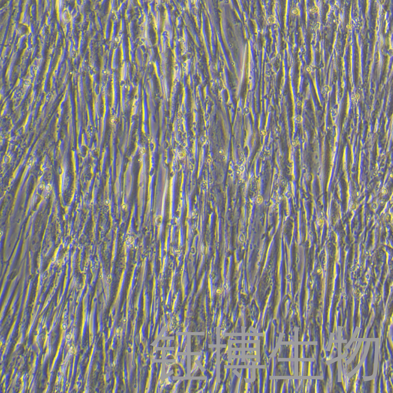 HGF-1（人牙龈成纤维细胞）YB-71356HC