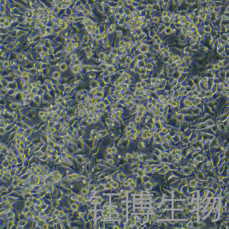 HO-8910（人卵巢癌细胞）YB-71113HC