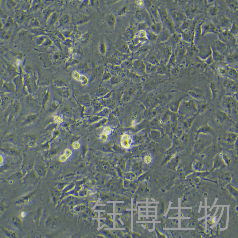 Hs 578Bst（人正常乳腺细胞）YB-71495HC