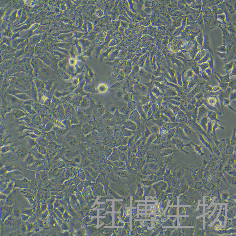 HuH-7（人肝癌细胞）YB-71120HC