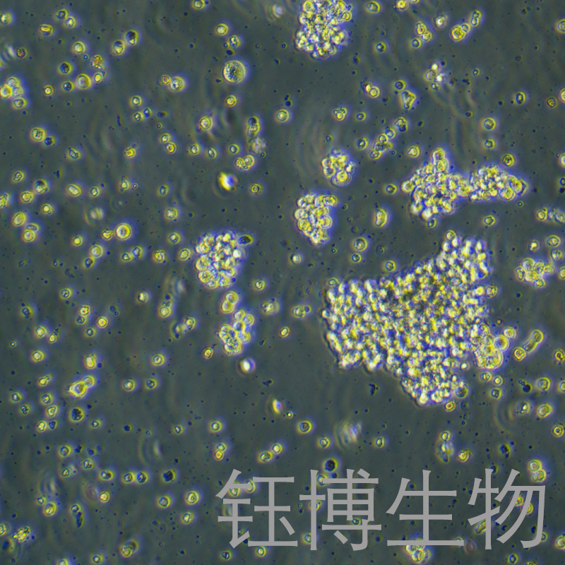 HuT 102（人T淋巴瘤细胞）YB-71121HC