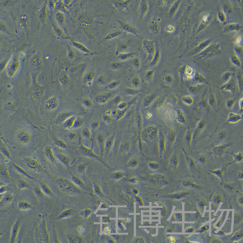 HUV-EC-C [HUVEC]（人脐静脉血管内皮细胞）YB-71122HC