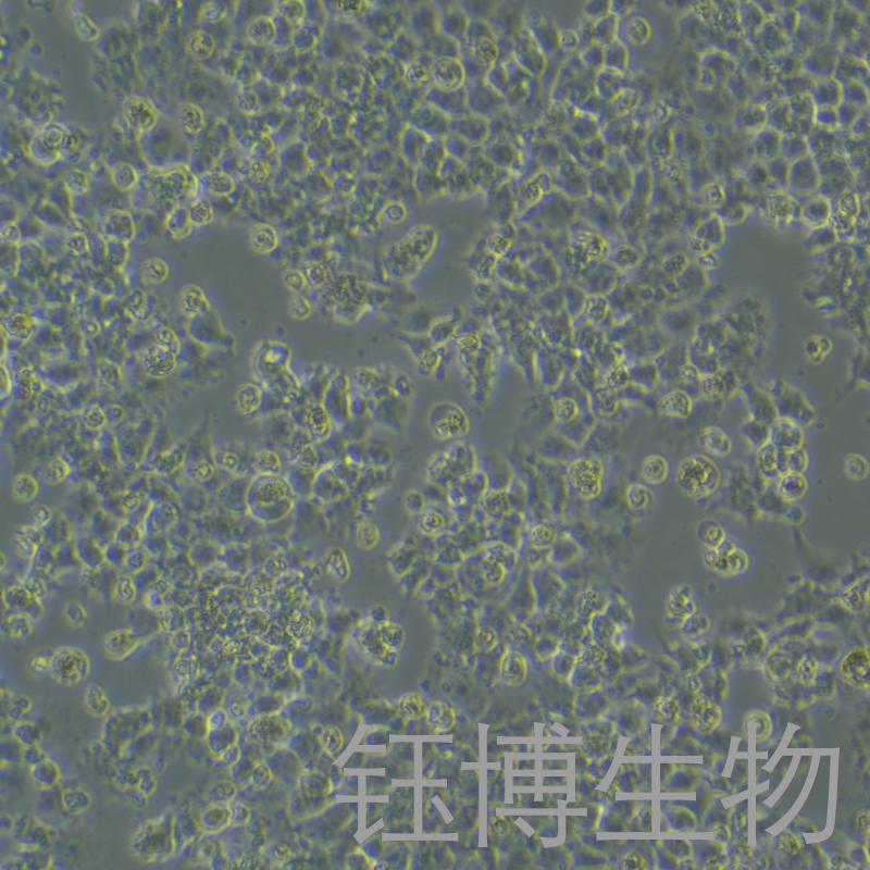 JAR（人胎盘绒毛癌细胞）YB-71126HC