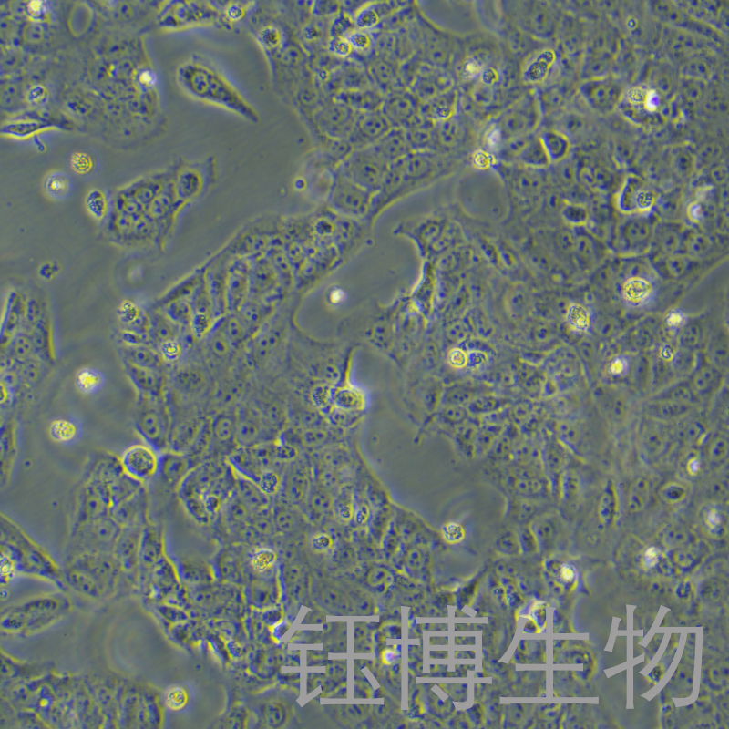 JEG-3（人绒毛膜癌细胞）YB-71127HC