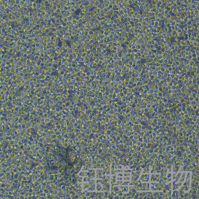 Jurkat, Clone E6-1（人T淋巴细胞白血病细胞）YB-71129HC