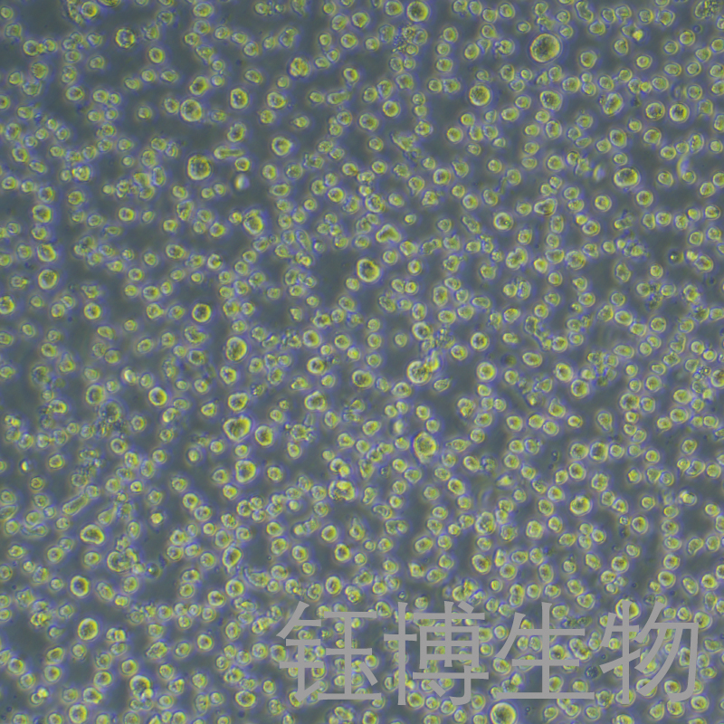 KG-1（人急性骨髓性白血病细胞）YB-71132HC