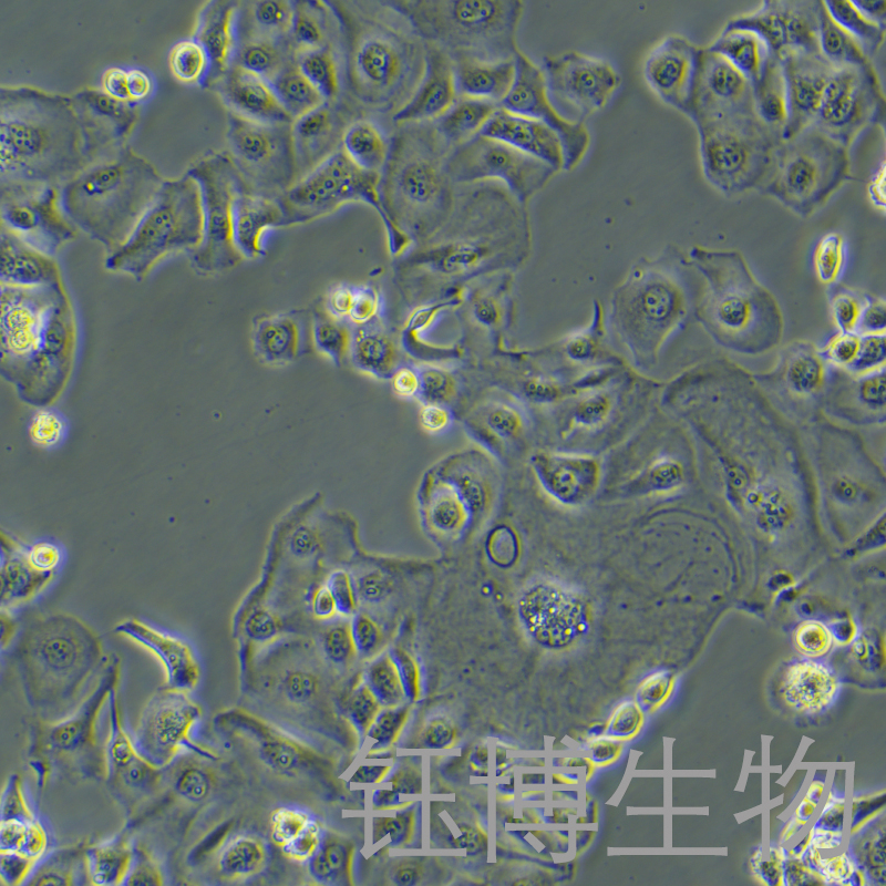 KLE（人子宫内膜癌细胞）YB-71133HC