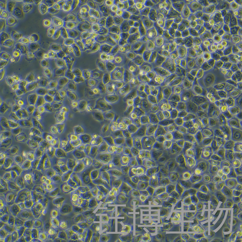 PC-9（人肺癌细胞）YB-71668HC
