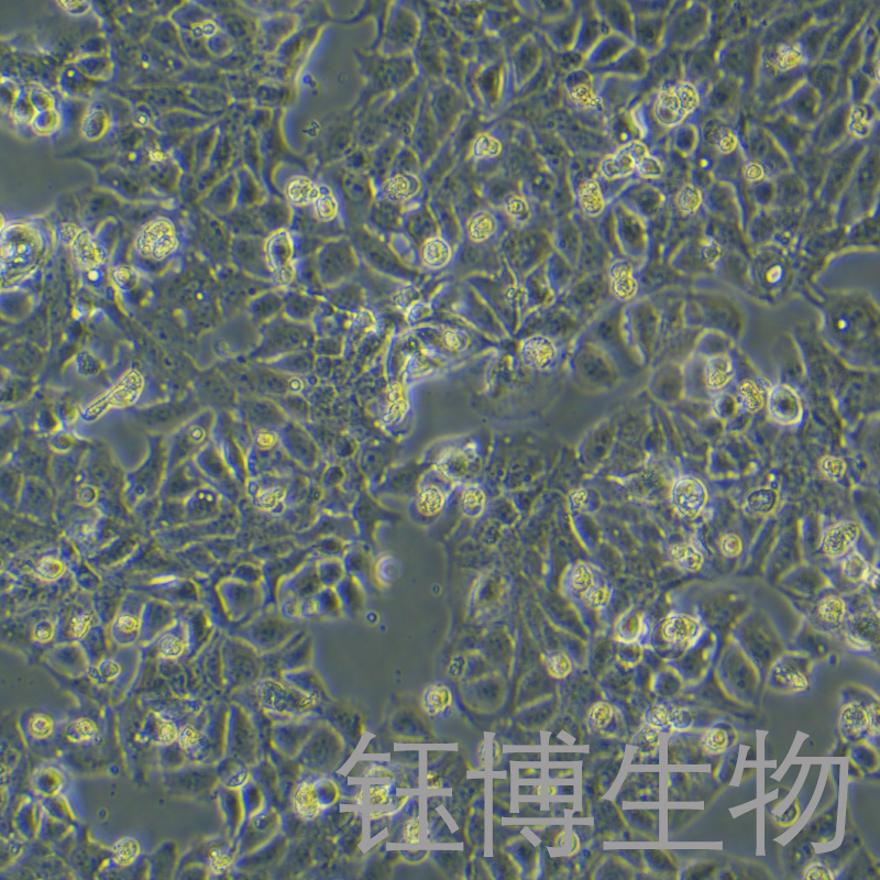 HT-1376（人膀胱癌细胞）YB-71672HC