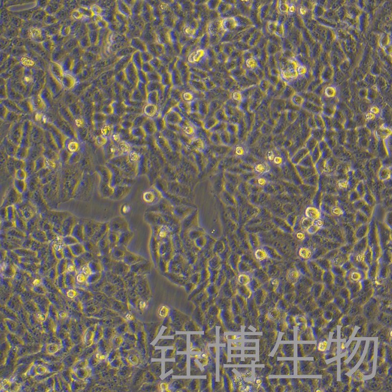 MADB106（大鼠乳腺癌细胞）YB-73148RC