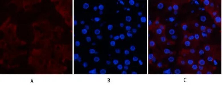 CD23 (3D1) Mouse Monoclonal Antibody