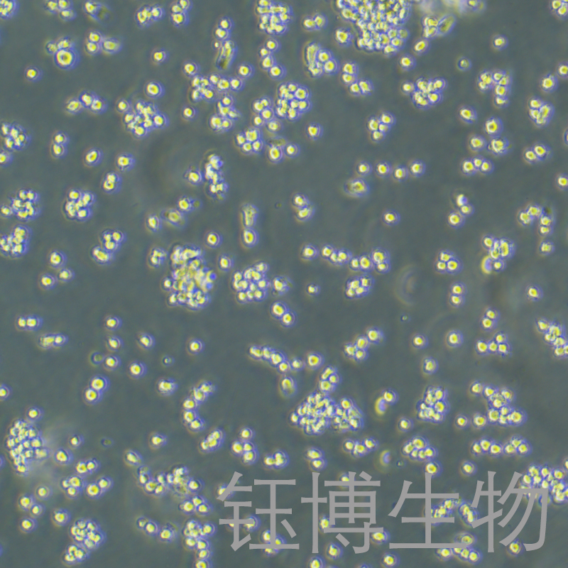 NR8383 [AgC11x3A; NR8383.1]（大鼠肺泡巨噬细胞）YB-73172RC