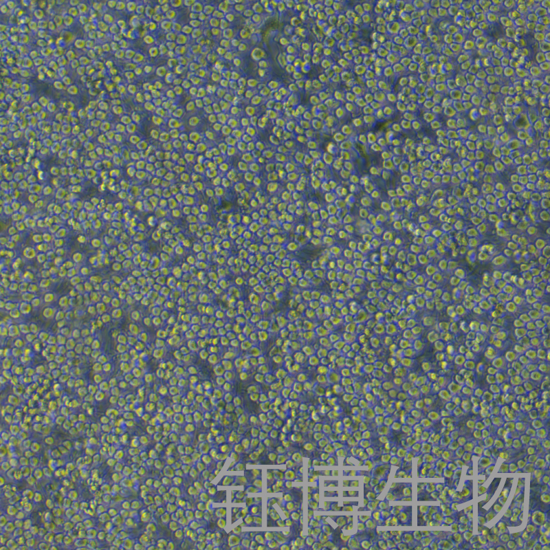 RBL-2H3（大鼠嗜碱性细胞白血病细胞）YB-73192RC