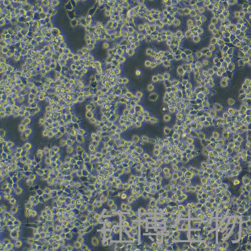 RH-35（大鼠肝癌细胞）YB-73195RC