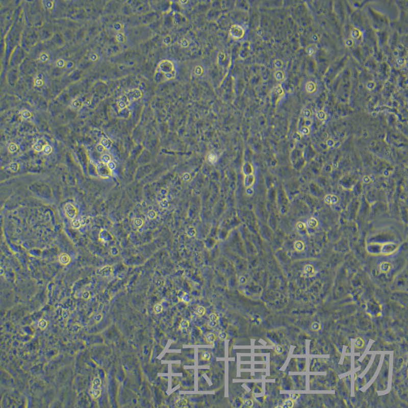UMR-106（大鼠骨肉瘤细胞）YB-73462RC