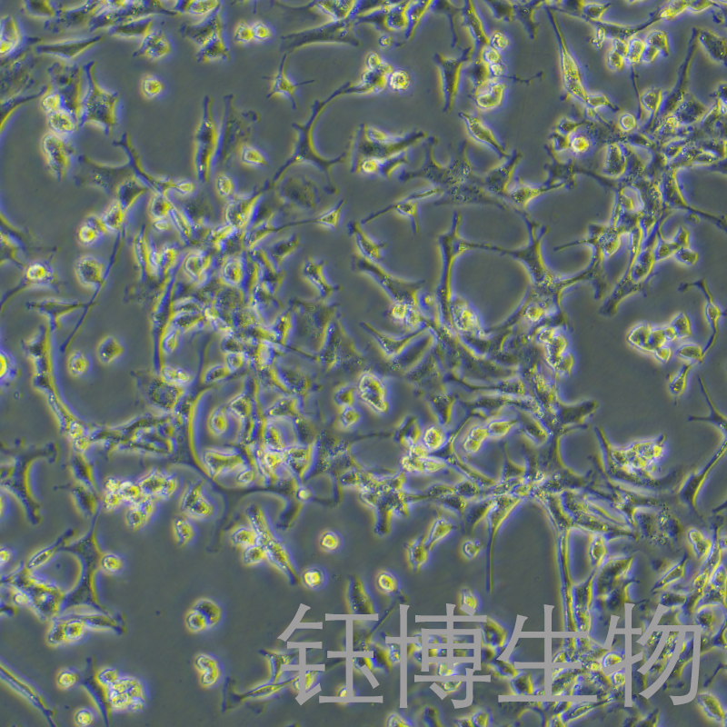 PC-12(低分化)（大鼠肾上腺嗜铬细胞瘤细胞（低分化））YB-73480RC