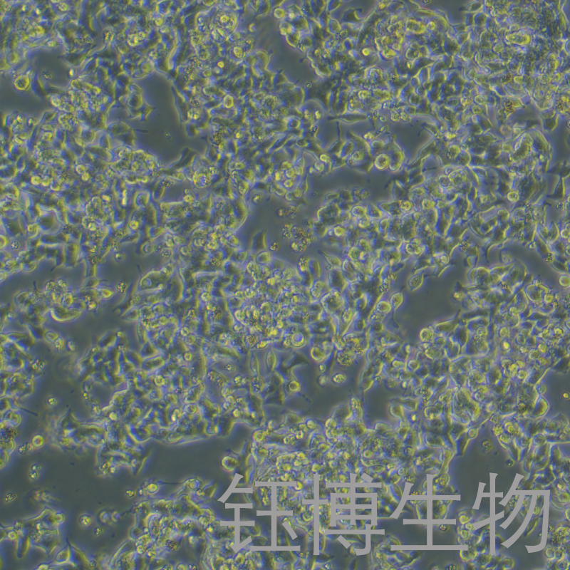 LS 174T [LS174T]（人结肠腺癌细胞）YB-71145HC