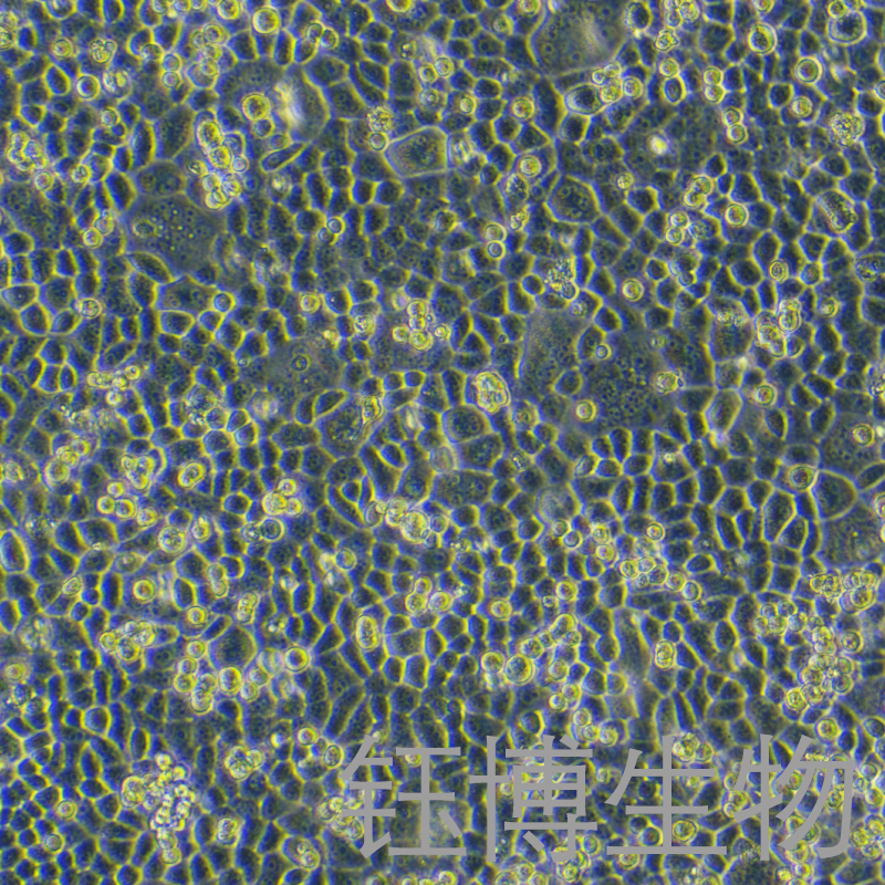 LTEP-a-2（人肺腺癌细胞）YB-71146HC