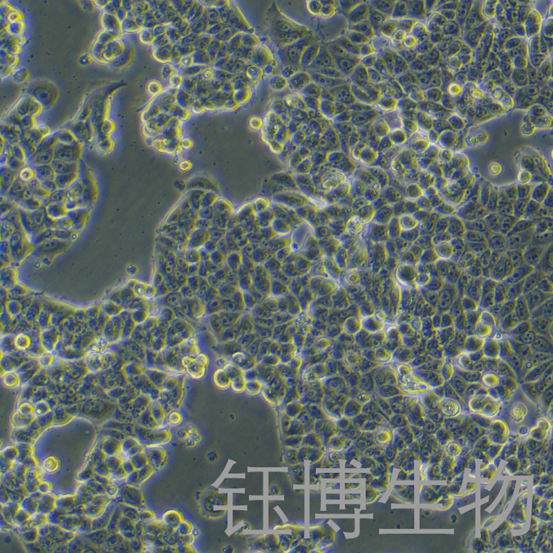 MCF7 [MCF-7]（人乳腺癌细胞）YB-71149HC