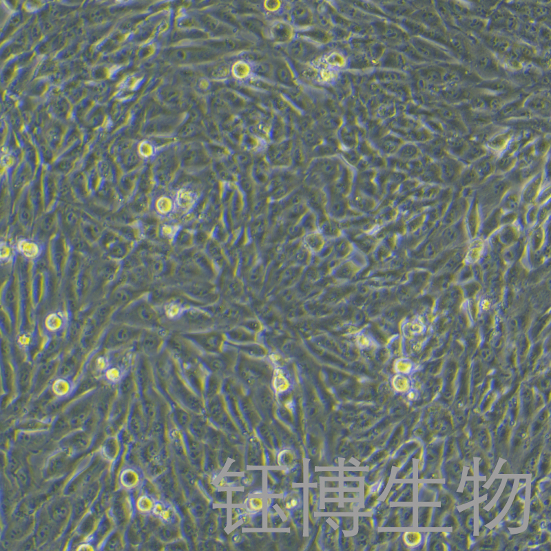 MG-63（人骨肉瘤细胞）YB-71157HC