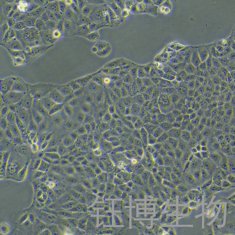 MKN-28（人胃癌高转移细胞）YB-71291HC
