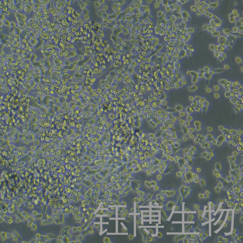 MKN-45（人胃癌细胞）YB-71292HC