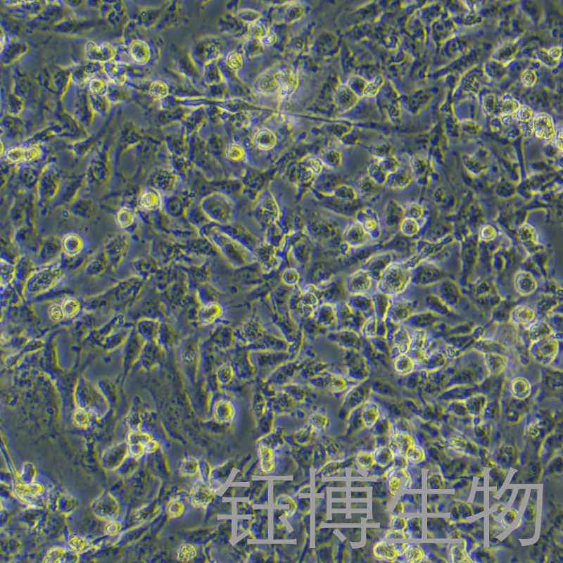 MuM-2B（人侵袭性脉络膜黑色素瘤细胞）YB-71293HC