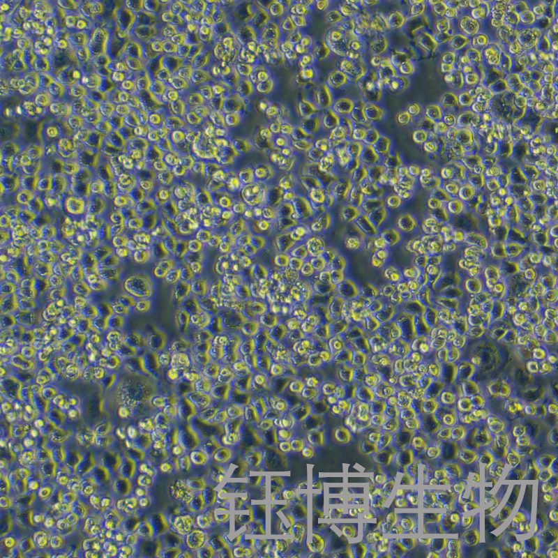 MX-1（人乳腺癌细胞）YB-71296HC