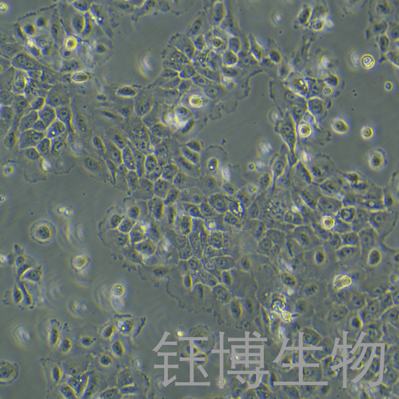 NCI-H292（人肺癌细胞(淋巴结转移)）YB-71167HC