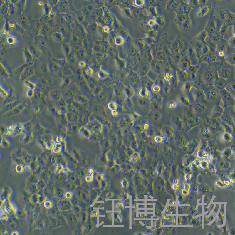 NCI-H1299（人非小细胞肺癌细胞）YB-71165HC