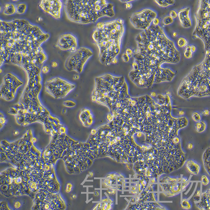 NCI-N87 [N87]（人胃癌细胞）YB-71169HC