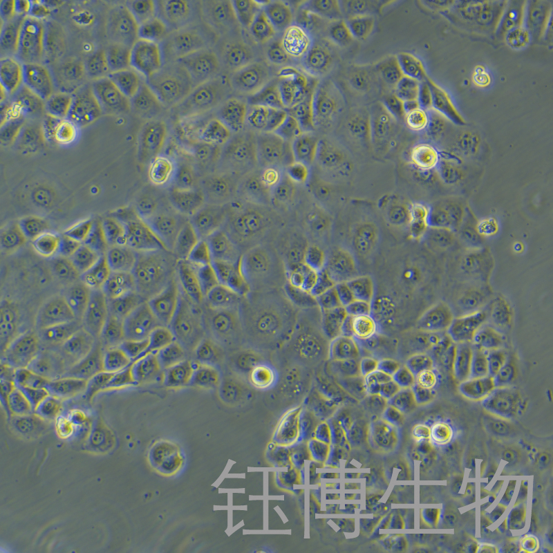 NIH:OVCAR-3 [OVCAR3]（人卵巢癌细胞）YB-71178HC