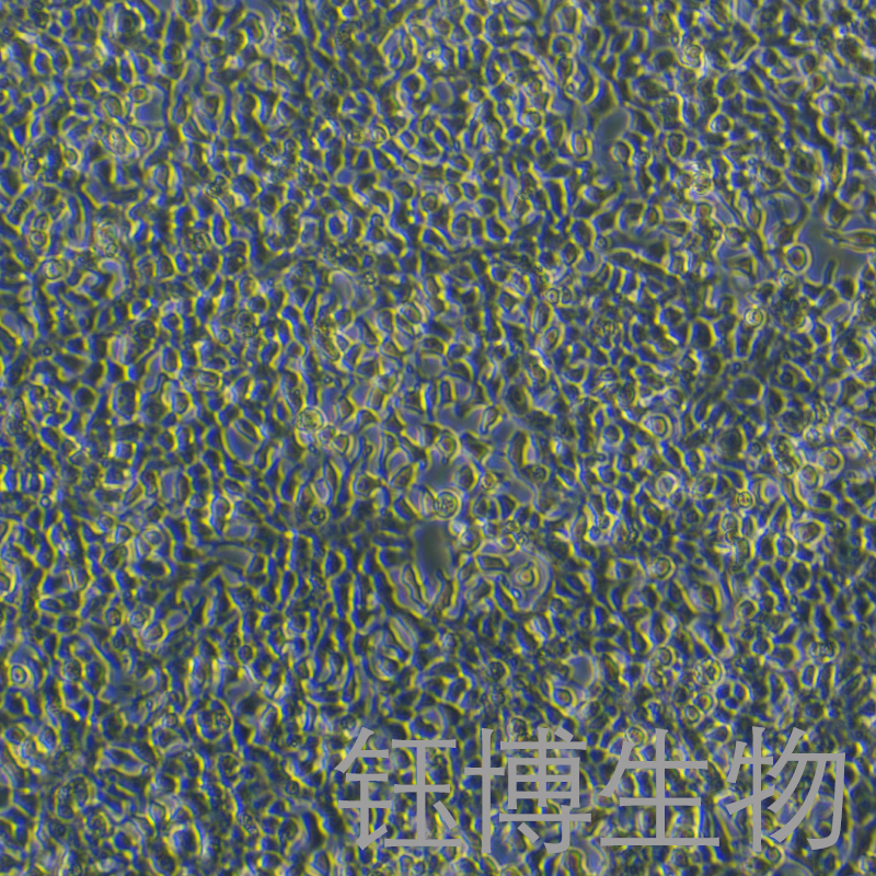 INS-1（大鼠胰岛细胞瘤细胞）YB-73368RC