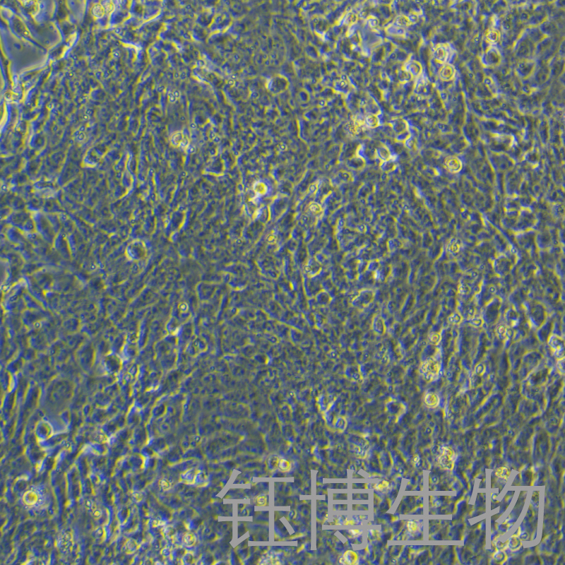 4T1（小鼠乳腺癌细胞）YB-72007MC