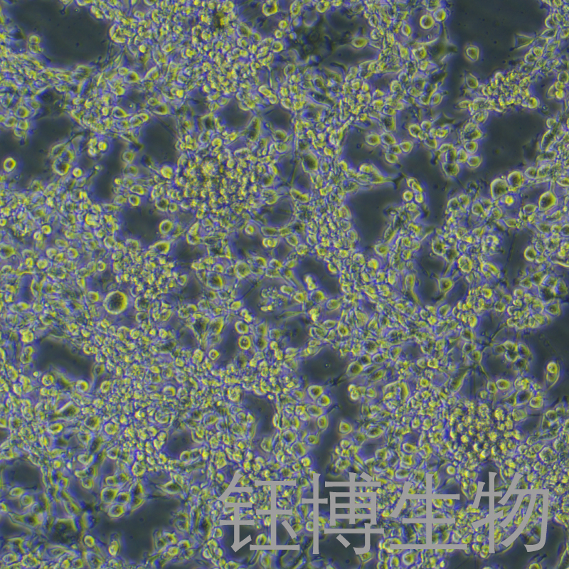 MFC（小鼠胃癌细胞）YB-72156MC